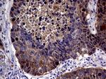 CDKN2A Antibody in Immunohistochemistry (Paraffin) (IHC (P))