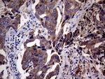 CDKN2A Antibody in Immunohistochemistry (Paraffin) (IHC (P))