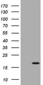 CDKN2A (p14ARF/p19ARF) Antibody in Western Blot (WB)