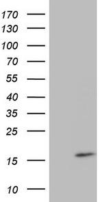 CDKN2A (p16INK4a) Antibody in Western Blot (WB)