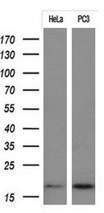 CDKN2A (p16INK4a) Antibody in Western Blot (WB)