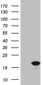 CDKN2A Antibody in Western Blot (WB)