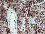 CDKN2B Antibody in Immunohistochemistry (Paraffin) (IHC (P))