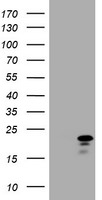 CDKN2C Antibody in Western Blot (WB)