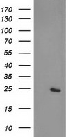 CDKN3 Antibody in Western Blot (WB)