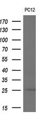 CDKN3 Antibody in Western Blot (WB)