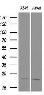 CDKN3 Antibody in Western Blot (WB)