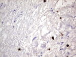 CEA (CEACAM5) Antibody in Immunohistochemistry (Paraffin) (IHC (P))