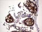 CEA (CEACAM5) Antibody in Immunohistochemistry (Paraffin) (IHC (P))