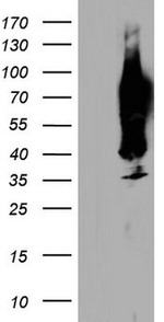 CEA (CEACAM5) Antibody in Western Blot (WB)