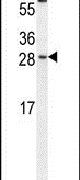 C/EBP gamma Antibody in Western Blot (WB)