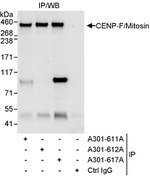 CENP-F/Mitosin Antibody in Immunoprecipitation (IP)