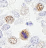 CENP-F/Mitosin Antibody in Immunohistochemistry (IHC)