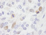 CENP-F/Mitosin Antibody in Immunohistochemistry (IHC)