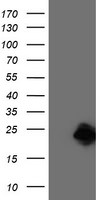 CENPH Antibody in Western Blot (WB)