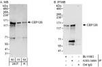CEP128 Antibody in Western Blot (WB)