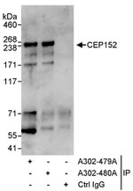 CEP152 Antibody in Immunoprecipitation (IP)