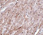 CEP164 Antibody in Immunohistochemistry (IHC)