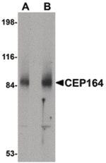 CEP164 Antibody in Western Blot (WB)