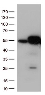 Calreticulin (CALR) Antibody in Western Blot (WB)