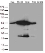 Calreticulin (CALR) Antibody in Western Blot (WB)