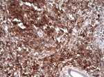 Caspase 3 (CASP3) Antibody in Immunohistochemistry (Paraffin) (IHC (P))