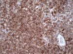 Caspase 3 (CASP3) Antibody in Immunohistochemistry (Paraffin) (IHC (P))