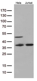 Caspase 3 (CASP3) Antibody in Western Blot (WB)