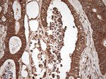 PKR (EIF2AK2) Antibody in Immunohistochemistry (Paraffin) (IHC (P))