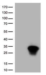 HSPB1 Antibody in Western Blot (WB)