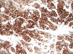 HSD17B13 Antibody in Immunohistochemistry (Paraffin) (IHC (P))