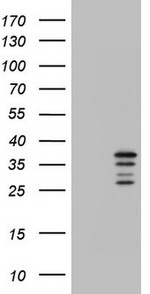 CHCHD3 Antibody in Western Blot (WB)