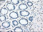 CHEK2 Antibody in Immunohistochemistry (Paraffin) (IHC (P))