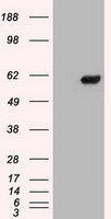 CHEK2 Antibody in Western Blot (WB)