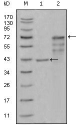 Chitotriosidase Antibody in Western Blot (WB)