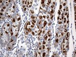 CHP1 Antibody in Immunohistochemistry (Paraffin) (IHC (P))