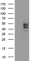 CHST6 Antibody in Western Blot (WB)