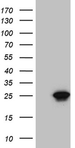 CIB1 Antibody in Western Blot (WB)