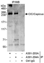 CIC/Capicua Antibody in Immunoprecipitation (IP)