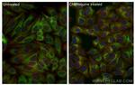 GABARAPL1 Antibody in Immunocytochemistry (ICC/IF)