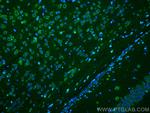 Ataxin 2 Antibody in Immunohistochemistry (PFA fixed) (IHC (PFA))