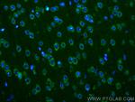 Ataxin 2 Antibody in Immunohistochemistry (PFA fixed) (IHC (PFA))