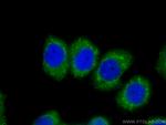 Stanniocalcin 2 Antibody in Immunocytochemistry (ICC/IF)