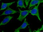 Cytoglobin Antibody in Immunocytochemistry (ICC/IF)