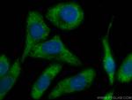 Fetuin-A Antibody in Immunocytochemistry (ICC/IF)