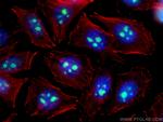 IMP3 Antibody in Immunocytochemistry (ICC/IF)