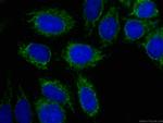 OGDH Antibody in Immunocytochemistry (ICC/IF)