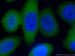 PKC iota Antibody in Immunocytochemistry (ICC/IF)