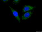 MFN1 Antibody in Immunocytochemistry (ICC/IF)
