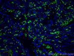 band 3/AE1 Antibody in Immunohistochemistry (PFA fixed) (IHC (PFA))